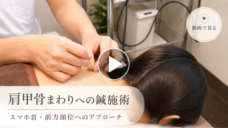 スマホ首・前方頭位への施術