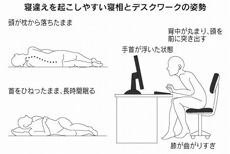 Sleeping phase and desk work posture that are prone to misplacement