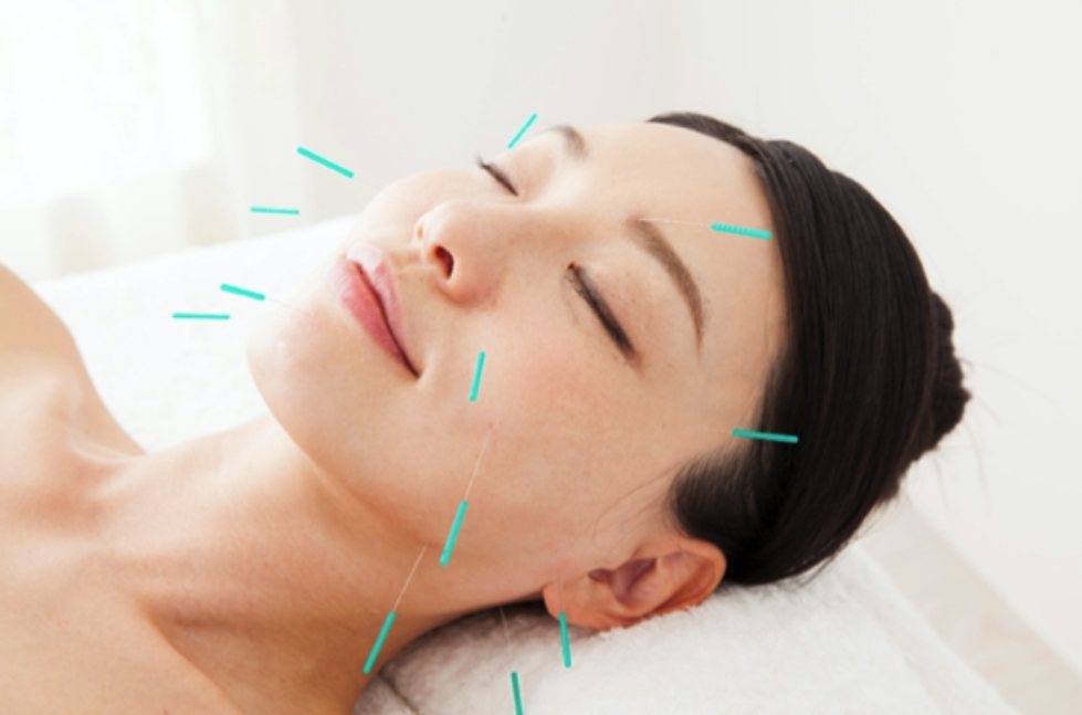 美容鍼 整体 鍼灸なら実績と信頼の メディカルジャパン新宿