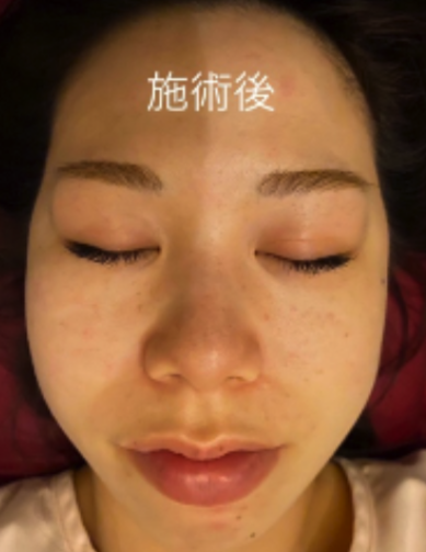 美容鍼 整体 鍼灸なら実績と信頼の メディカルジャパン立川