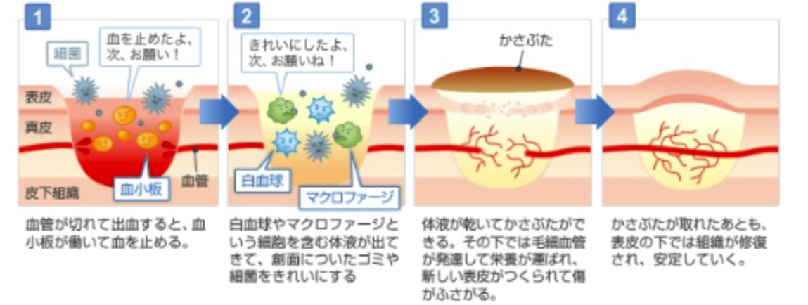 美容鍼 整体 鍼灸なら実績と信頼の メディカルジャパン立川
