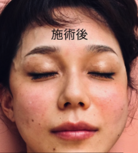 美容鍼 整体 鍼灸なら実績と信頼の メディカルジャパン立川