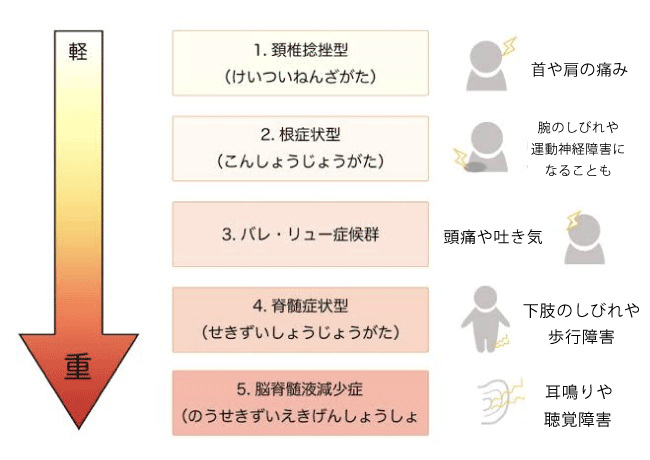 頸椎捻挫 整体 鍼灸なら実績と信頼の メディカルジャパン立川