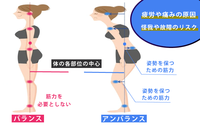 なぜアンバランスは立位の際に、筋肉を緊張させるのでしょうか?