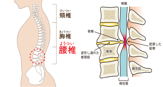 椎間板ヘルニア 整体 鍼灸なら実績と信頼の メディカルジャパン新宿 駅徒歩1分