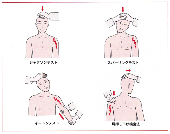 ムチウチ 頚椎捻挫 頸部損傷 整体 鍼灸なら実績と信頼の メディカルジャパン立川