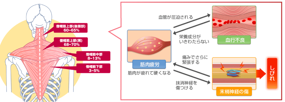 肩こり 整体 鍼灸なら実績と信頼の メディカルジャパン立川