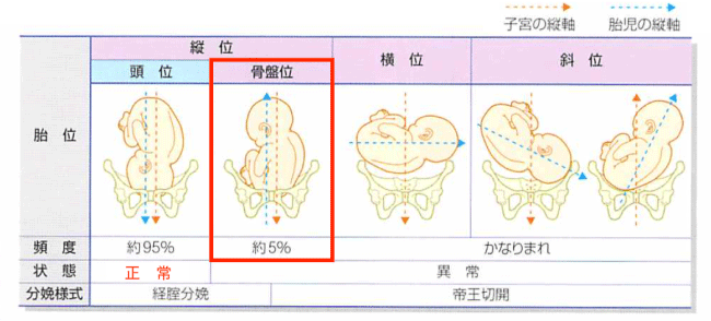 逆子改善プログラム 整体 鍼灸なら実績と信頼の メディカルジャパン新宿