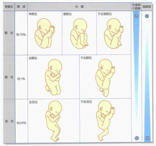 逆子改善プログラム 整体 鍼灸なら実績と信頼の メディカルジャパン新宿