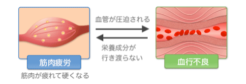 筋肉の疲労