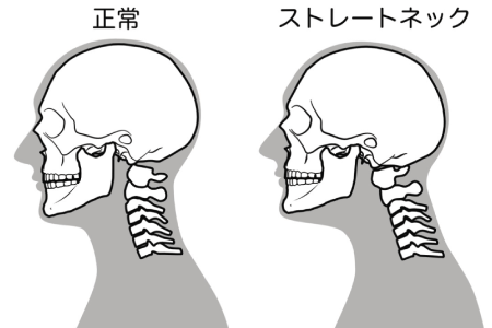 投稿の画像