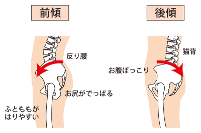 骨盤、前傾、後傾