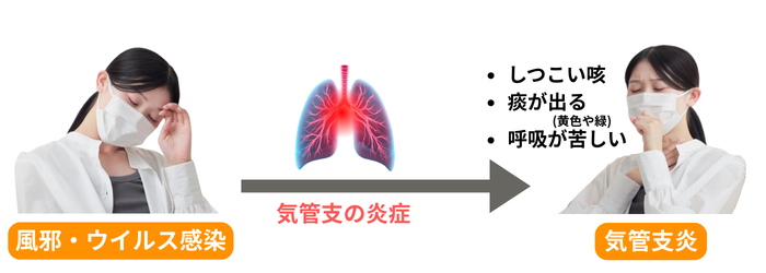 風邪から気管支炎への進行
