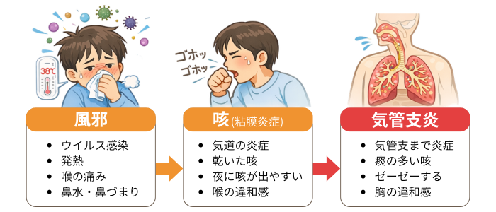 風邪から咳、気管支炎へ進行する流れの図解